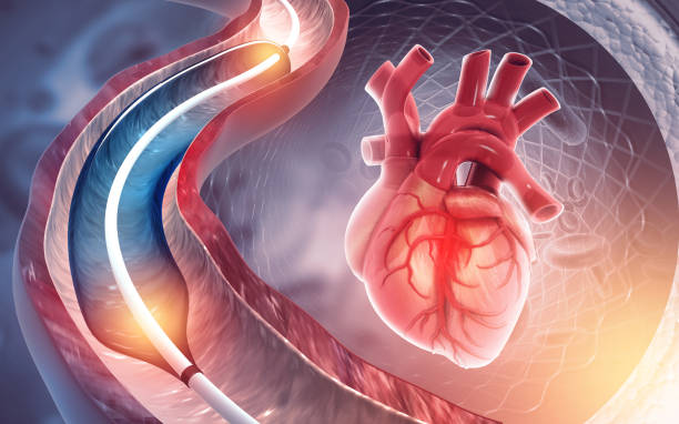 best cardiologist for angiography in south mumbai